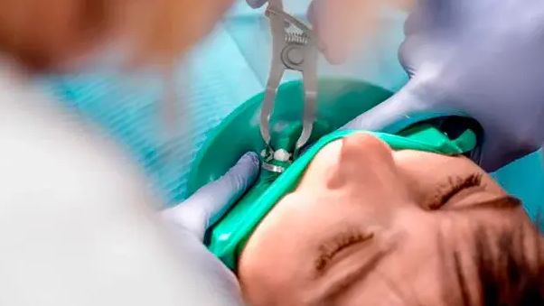 Intervento Dentale Finisce in Incubo: Estratti 11 Denti Sani e Due Dentisti Condannati