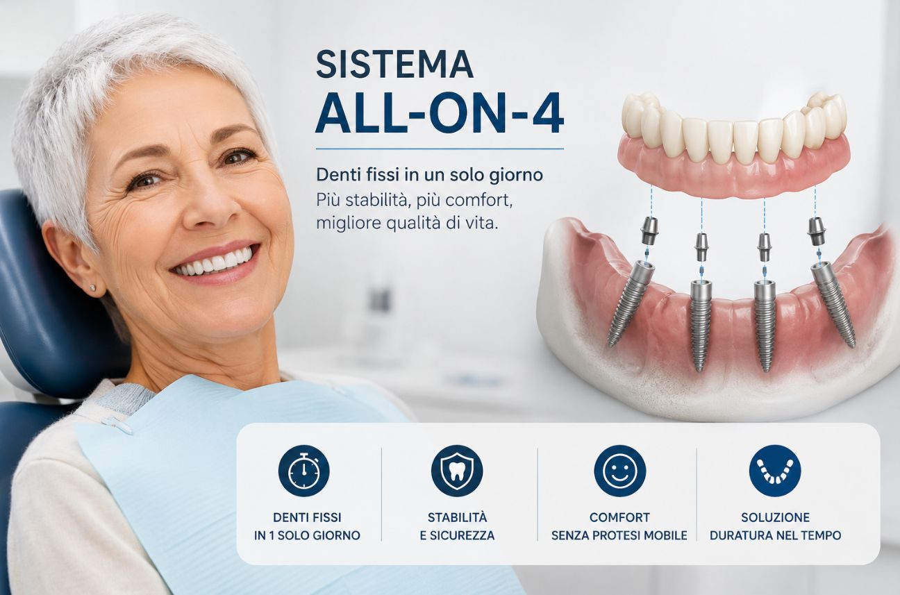 Sistema All-on-4 con quattro impianti dentali che supportano un'arcata fissa completa, illustrato accanto a una paziente sorridente dopo la riabilitazione implantare.