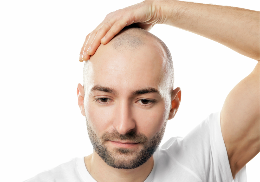 Trapianto di capelli Budapest, Ungheria